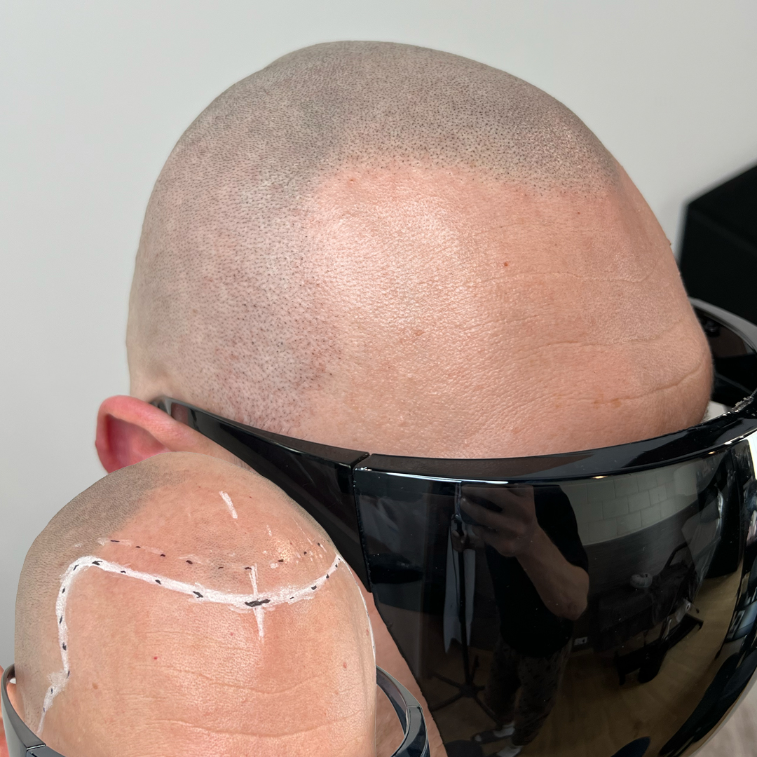 shaved head