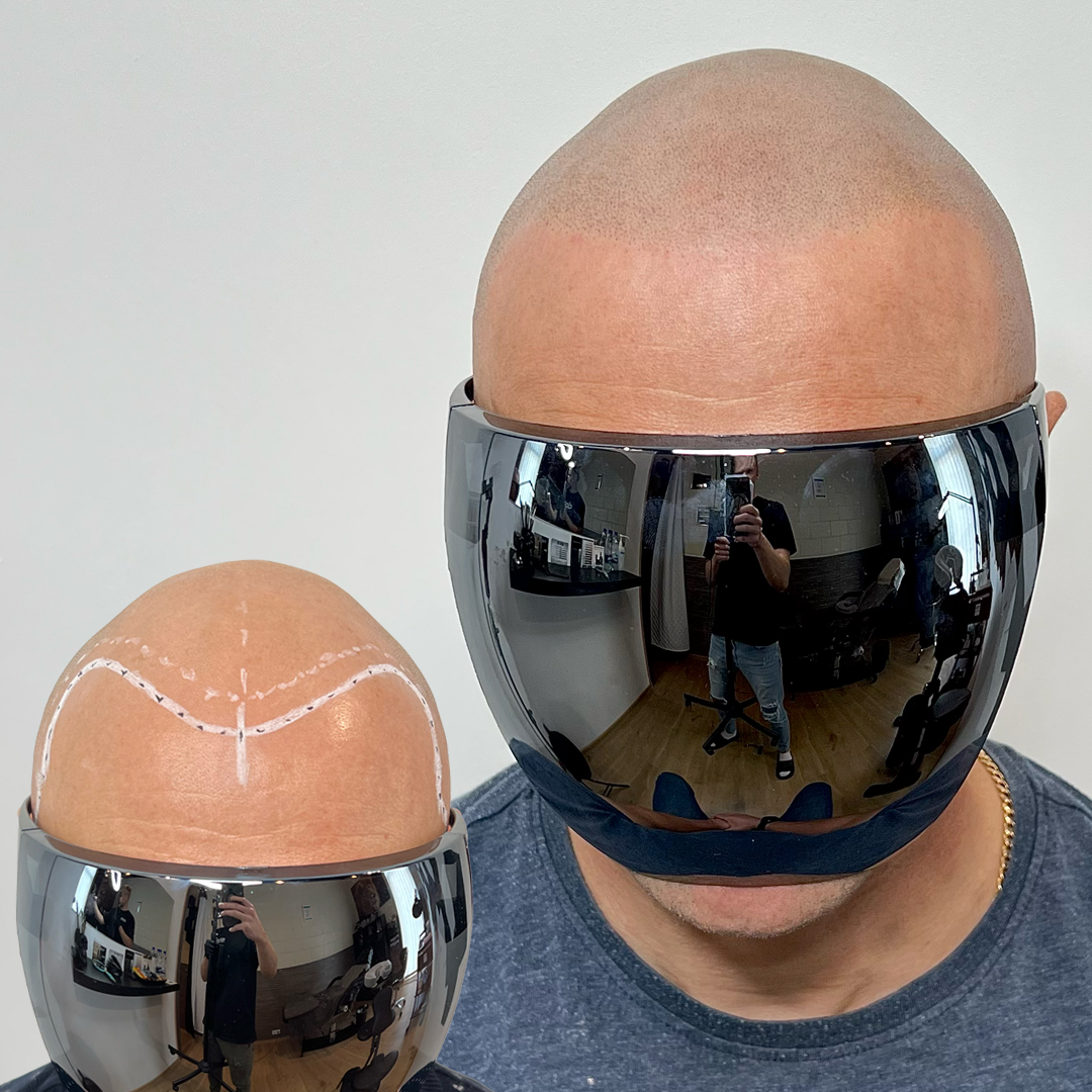 Shaved head