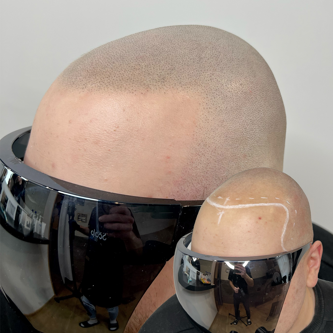 Shaved head