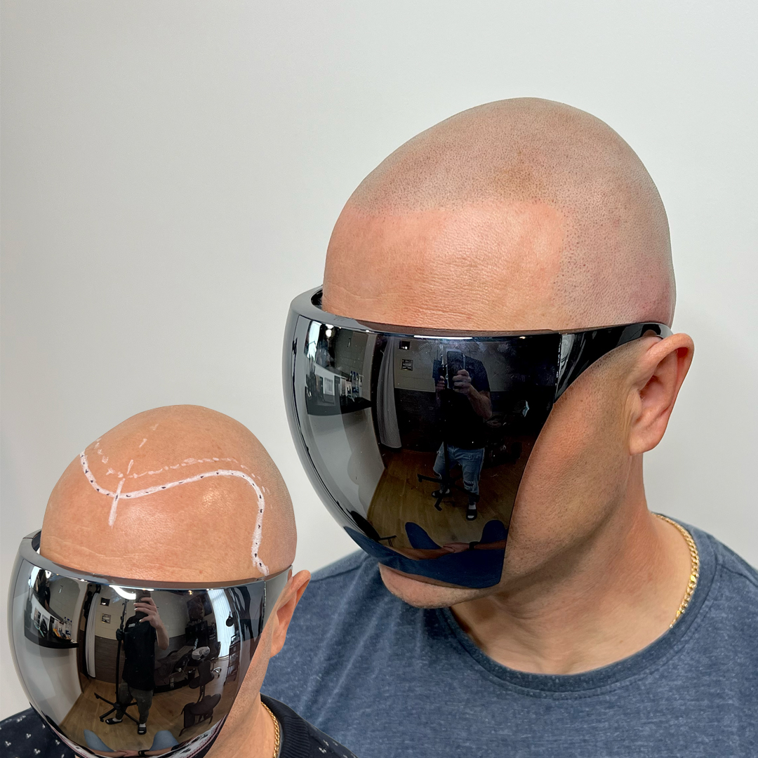 Shaved head