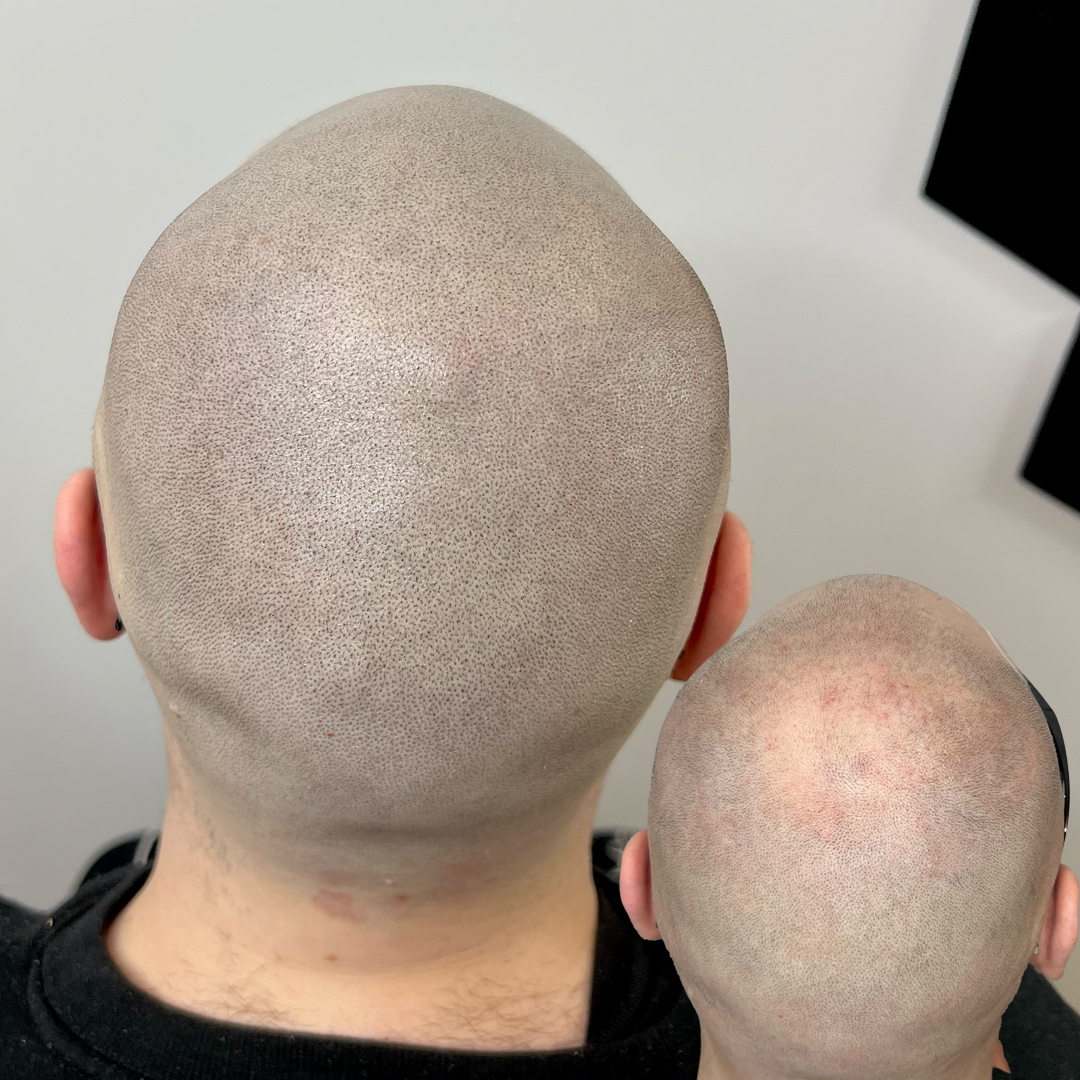 Shaved head
