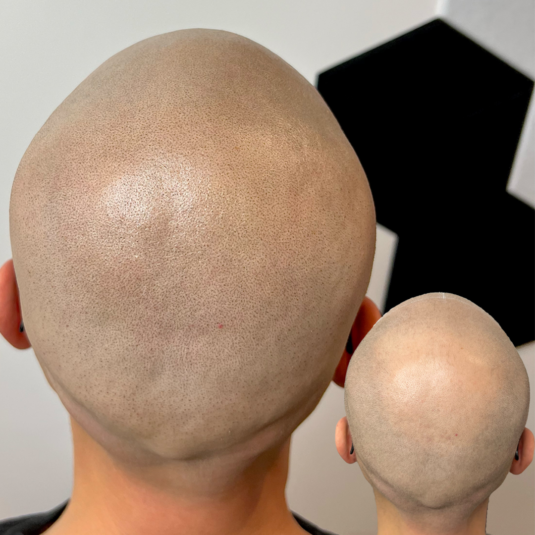 Shaved head