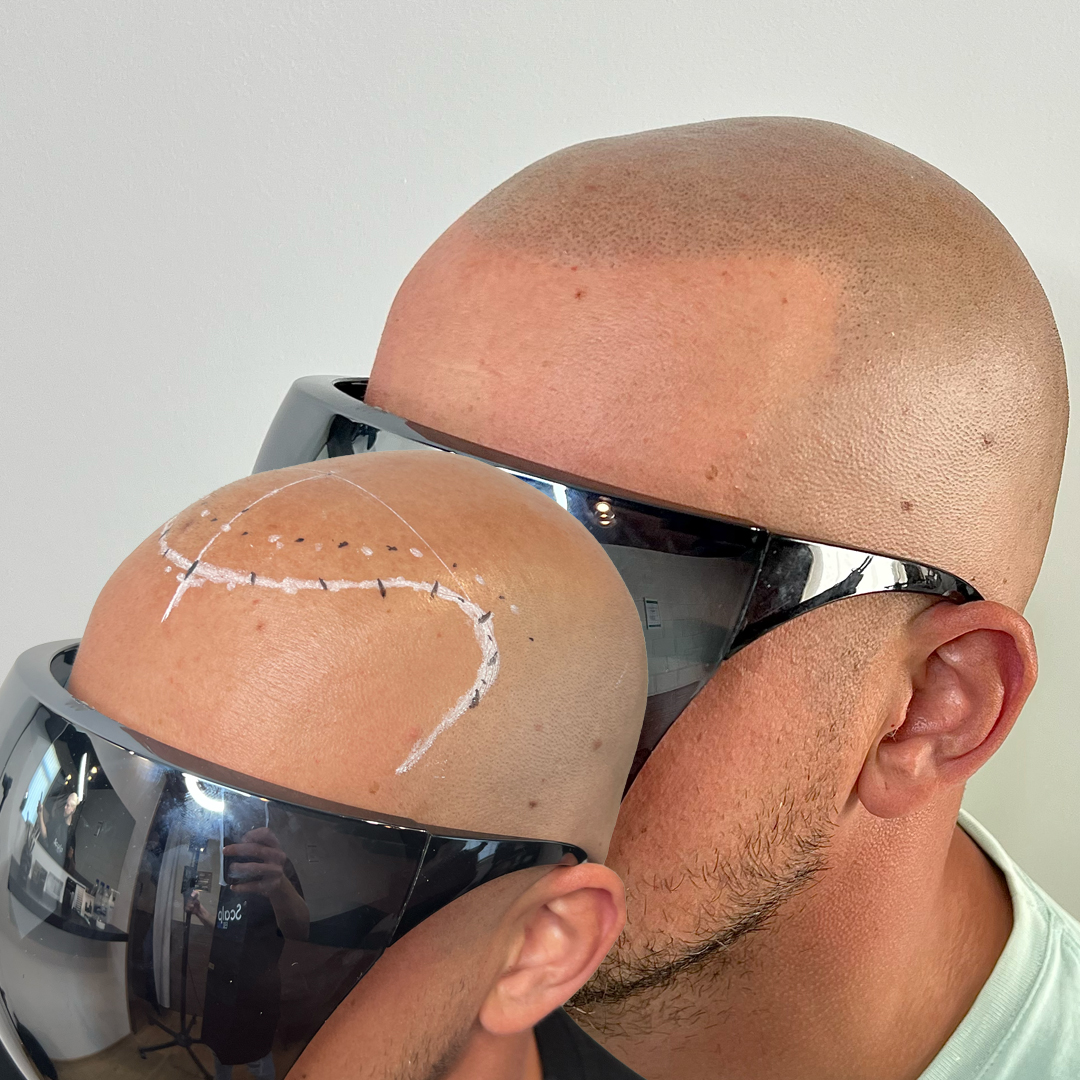 shaved head 4
