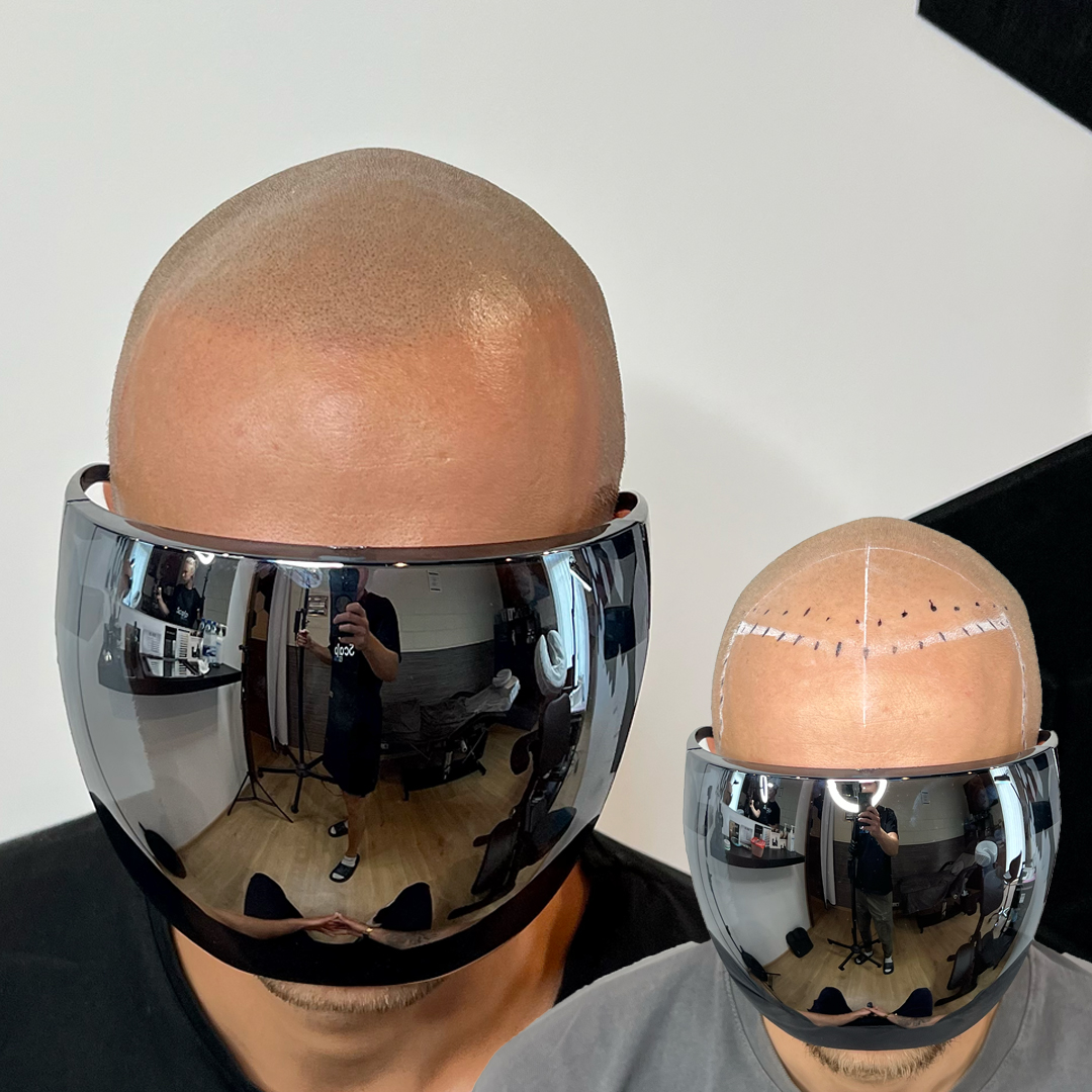 shaved head 1