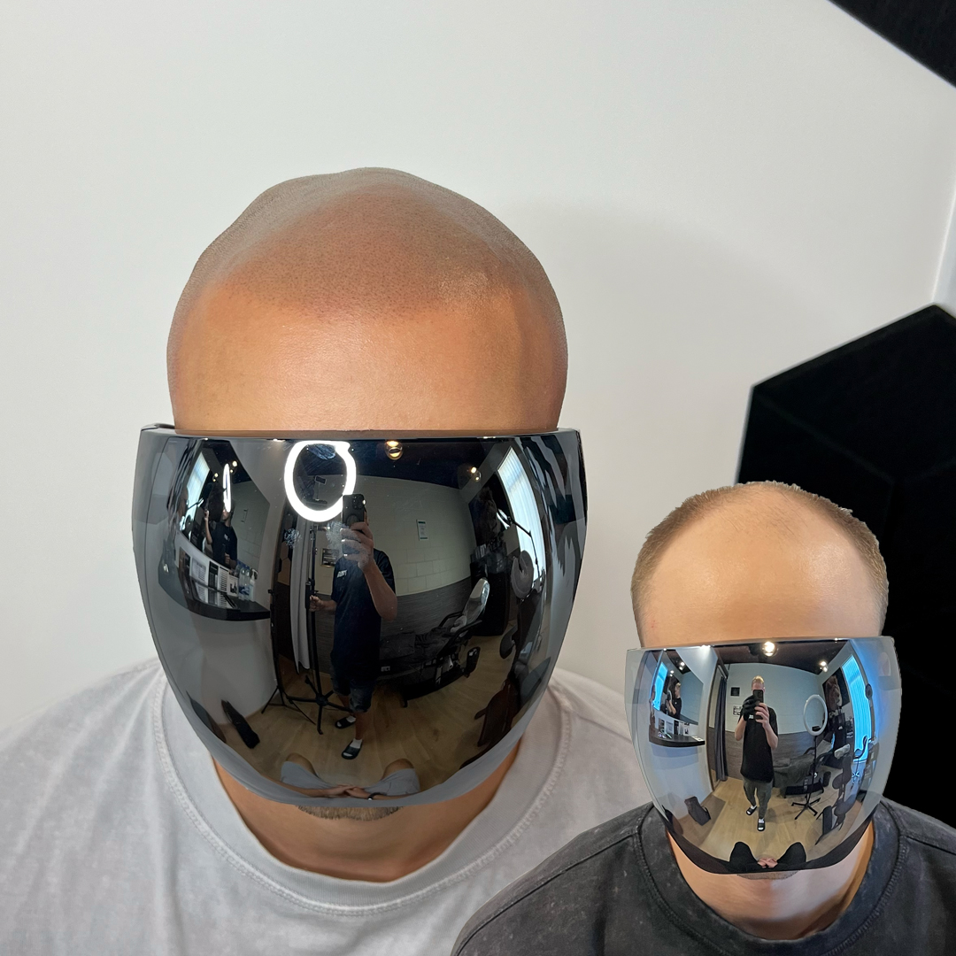 shaved head 3