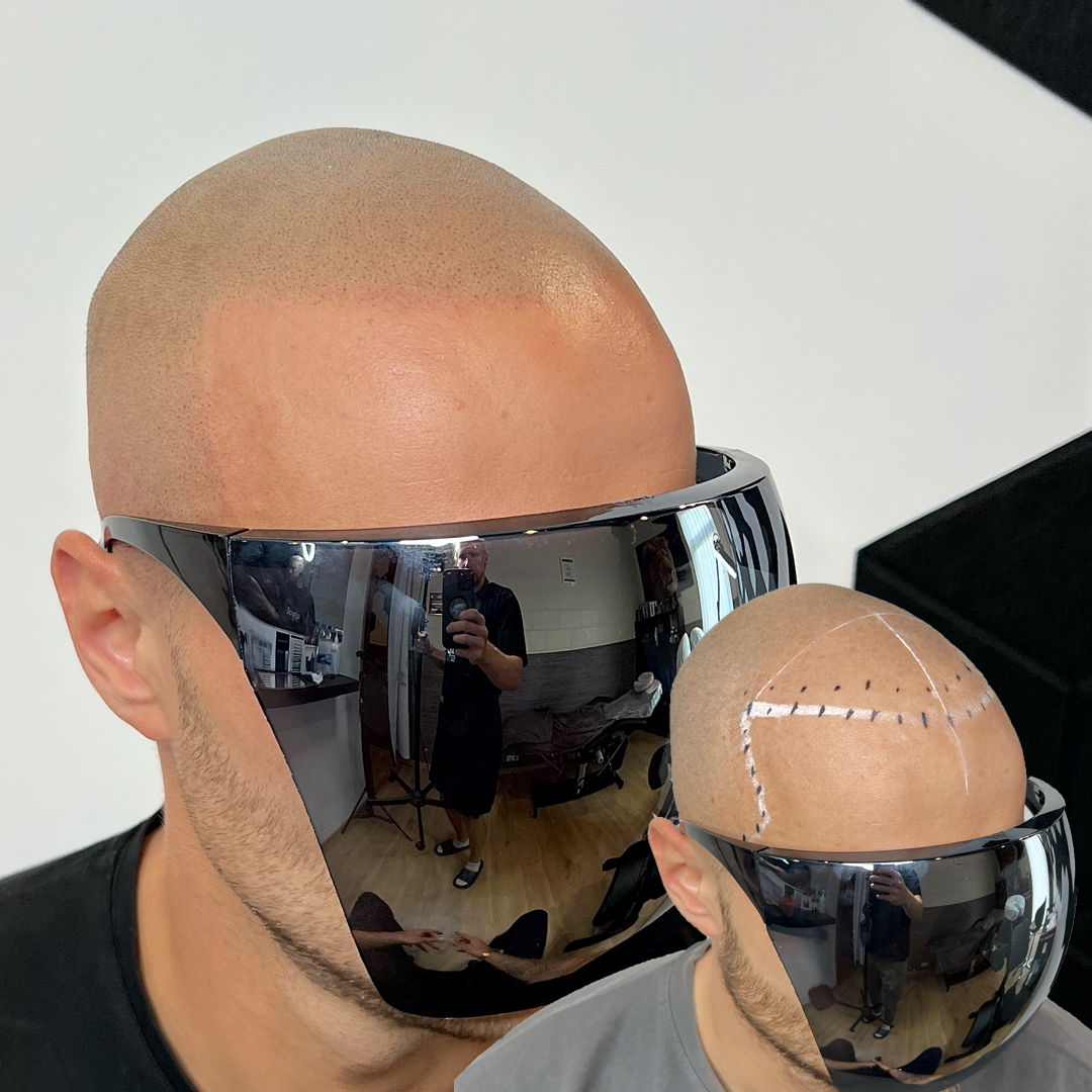 shaved head 1