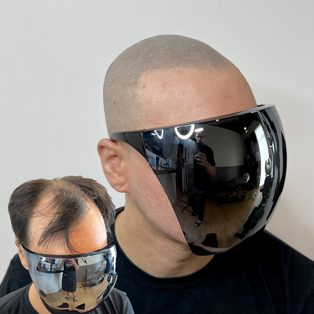 shaved head 14