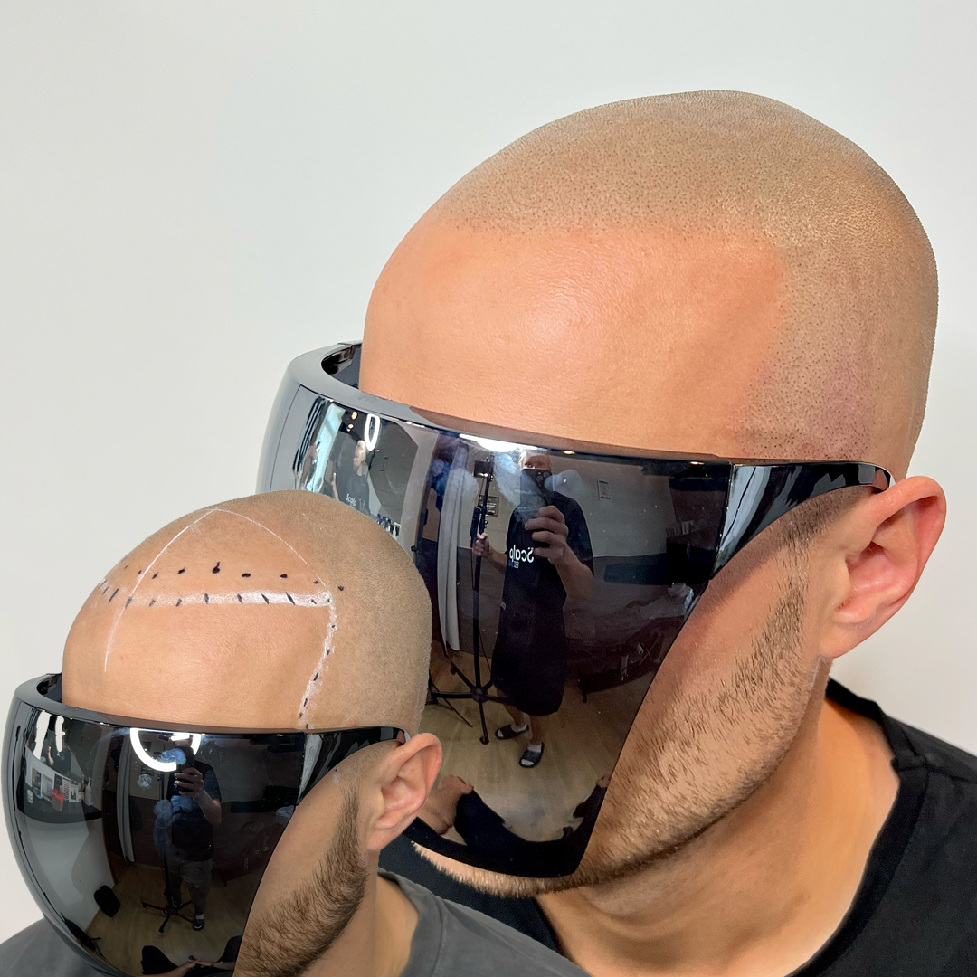 shaved head 1