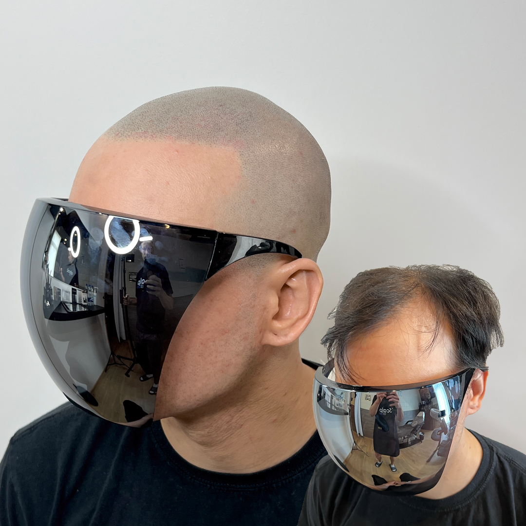 shaved head 14